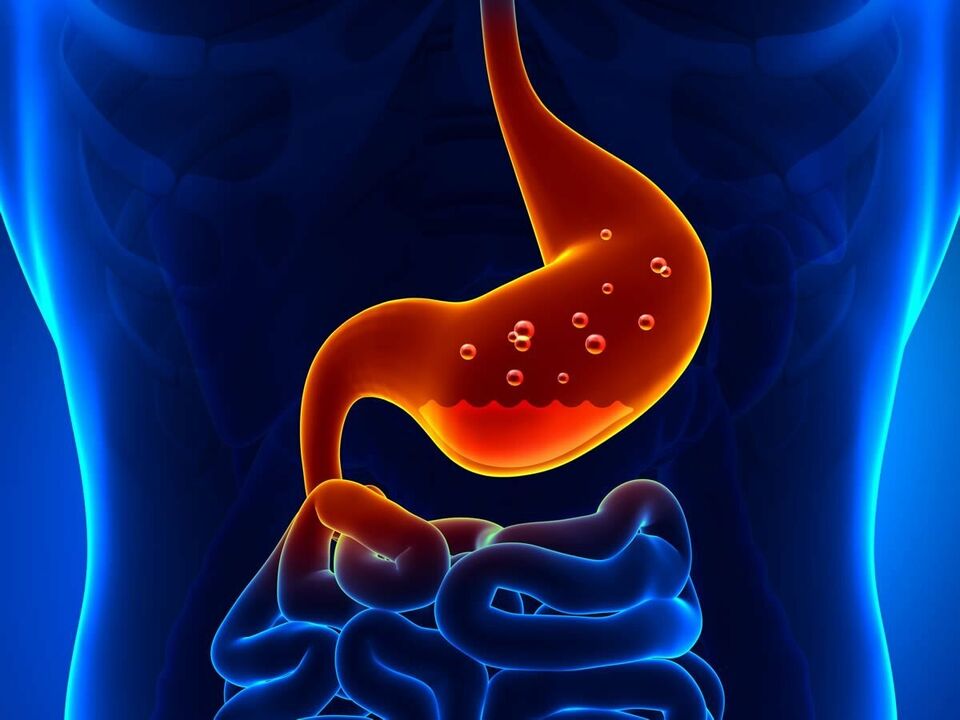 A gastrite é unha enfermidade inflamatoria do estómago que require nutrición